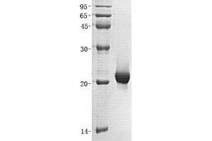 Validation with Western Blot (SENP7 Protein (Transcript Variant 2) (His tag))