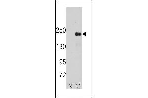 Western blot analysis of SG9 (arrow) using rabbit polyclonal SG9 Antibody (Center) (ABIN391447 and ABIN2841430). (SPAG9 antibody  (AA 603-632))