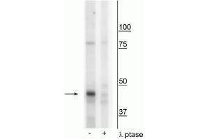 Western blot of mouse mitochondria from whole brain lysate showing specific immunolabeling of the ~46 kDa CK1Mt protein phosphorylated at Tyr153 in the first lane (-).