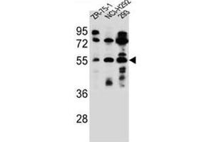 Western blot analysis of FUT6 Antibody (N-term) in ZR-75-1, NCI-H292, 293 cell line lysates (35ug/lane). (FUT6 antibody  (N-Term))
