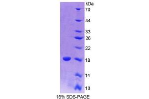SDS-PAGE analysis of Mouse CALY Protein.