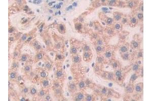 Detection of Slit1 in Rat Liver Tissue using Polyclonal Antibody to Slit Homolog 1 (Slit1) (SLIT1 antibody  (AA 308-512))
