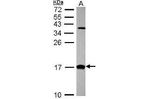 WB Image Sample (30 ug of whole cell lysate) A: Hep G2 , 15% SDS PAGE diluted at 1:1000 (CRABP2 antibody)