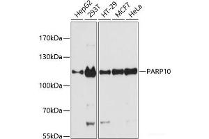 Western blot analysis of extracts of various cell lines using PARP10 Polyclonal Antibody at dilution of 1:3000. (PARP10 antibody)