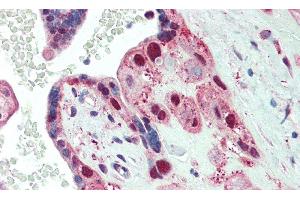 Detection of SPTbN4 in Human Placenta Tissue using Polyclonal Antibody to Spectrin Beta, Non Erythrocytic 4 (SPTbN4) (SPTBN4 antibody  (AA 64-285))