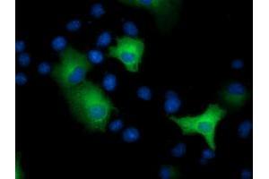 Anti-EPHX2 mouse monoclonal antibody (ABIN2452992) immunofluorescent staining of COS7 cells transiently transfected by pCMV6-ENTRY EPHX2 (RC202489). (EPHX2 antibody)