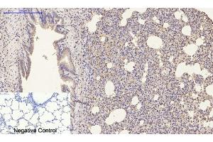 Immunohistochemical analysis of paraffin-embedded rat lung tissue. (Luciferase antibody)
