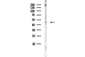 anti-F-Box Protein 22 (FBXO22) (Internal Region) antibody