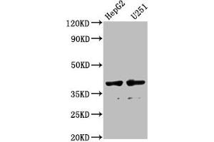 Western Blot Positive WB detected in: HepG2 whole cell lysate, U251 whole cell lysate All lanes: AMBP antibody at 1:1000 Secondary Goat polyclonal to rabbit IgG at 1/50000 dilution Predicted band size: 39 kDa Observed band size: 39 kDa (AMBP antibody  (AA 20-203))