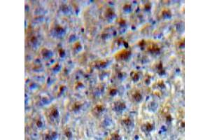 Used in DAB staining on fromalin fixed paraffin-embedded Liver tissue (TCF20 antibody  (AA 125-213))