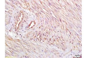 Formalin-fixed and paraffin embedded human endometrium tissue labeled with Anti EDNR8 Polyclonal Antibody, Unconjugated (ABIN679973) at 1:200 followed by conjugation to the secondary antibody and DAB staining (EDNRB antibody  (AA 31-130))