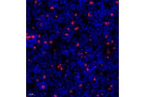 Immunofluorescence of paraffin embedded mouse spleen using ly6g (ABIN7074524) at dilution of 1:600 (400x lens) (Ly6g antibody)