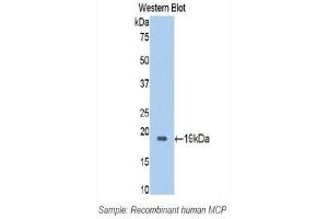 Western Blotting (WB) image for anti-CD46 (CD46) (AA 147-285) antibody (ABIN1174444) (CD46 antibody  (AA 147-285))