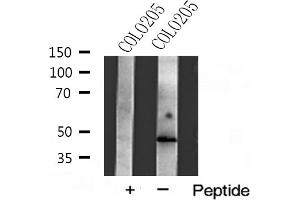 Western blot analysis of Actin γ2 expression in COLO205 cells (ACTG2 antibody  (N-Term))