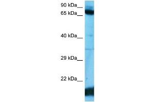 Host:  Rabbit  Target Name:  ZN182  Sample Type:  ACHN Whole Cell  Antibody Dilution:  1. (ZNF182 antibody  (C-Term))
