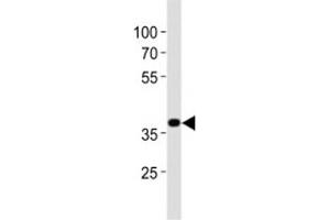 Western blot analysis of lysate from mouse stomach tissue lysate using Nkx2. (NK2 Homeobox 5 antibody  (AA 192-235))