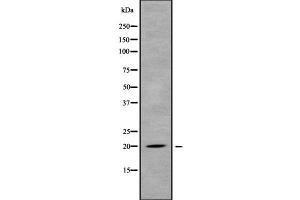 Western blot analysis of MED30 using MCF7 whole cell lysates (MED30 antibody  (Internal Region))