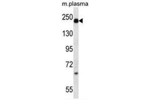 A2M Antibody (alpha 2 Macroglobulin antibody  (N-Term))