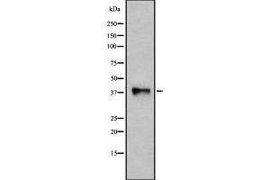 Western blot analysis of P2RY10 using HUVEC whole cell lysates (P2RY10 antibody  (Internal Region))