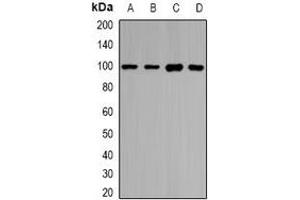 Western blot analysis of HIWI1 expression in HepG2 (A), SKOV3 (B), mouse testis (C), rat testis (D) whole cell lysates.