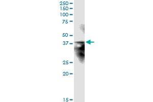 Immunoprecipitation of STX12 transfected lysate using anti-STX12 MaxPab rabbit polyclonal antibody and Protein A Magnetic Bead , and immunoblotted with STX12 MaxPab mouse polyclonal antibody (B01) . (Syntaxin 12 antibody  (AA 1-276))