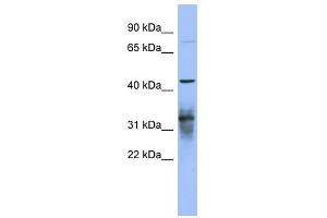 PABPC5 antibody used at 1 ug/ml to detect target protein. (PABPC5 antibody)