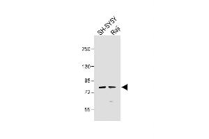 All lanes : Anti-K5 Antibody at 1:1000 dilution Lane 1: SH-SY5Y whole cell lysate Lane 2: Raji whole cell lysate Lysates/proteins at 20 μg per lane.