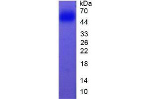 Image no. 1 for Cytochrome P450, Family 1, Subfamily A, Polypeptide 2 (CYP1A2) (AA 2-231) (Active) protein (His tag,GST tag) (ABIN6239866)