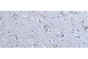 ZNF703 antibody