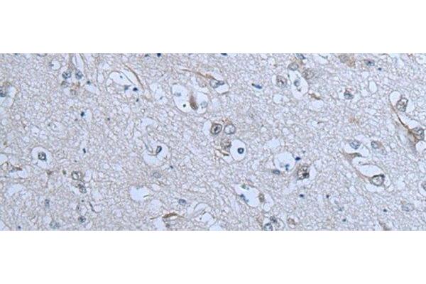 ZNF703 antibody