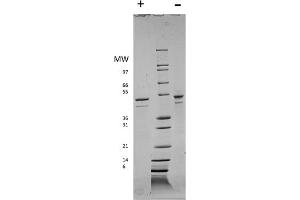 SDS-PAGE of Human Visfatin Recombinant Protein SDS-PAGE of Human Visfatin Recombinant Protein.