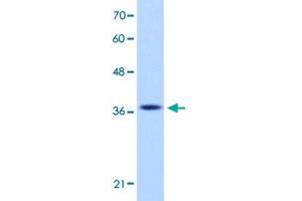 EXOSC7 antibody  (N-Term)