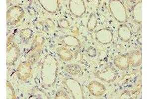 Immunohistochemistry of paraffin-embedded human kidney tissue using ABIN7145213 at dilution of 1:100 (BAG2 antibody  (AA 1-211))