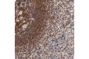 Immunohistochemical staining of human spleen with WIPF1 polyclonal antibody  shows strong cytoplasmic positivity in cells in red pulp and cells in white pulp. (WIPF1 antibody)