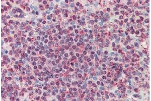 Anti-CD70 antibody  ABIN960750 IHC staining of human spleen. (CD70 antibody  (Internal Region))