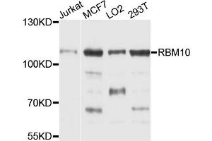 Western blot analysis of extracts of various cell lines, using RBM10 antibody (ABIN1874563) at 1:1000 dilution. (RBM10 antibody)