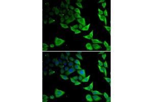 Immunofluorescence analysis of MCF-7 cells using SNCA antibody. (SNCA antibody  (AA 61-140))