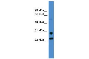 WB Suggested Anti-KIAA0152 Antibody Titration:  0. (Malectin antibody  (C-Term))