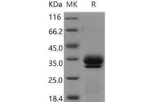 Western Blotting (WB) image for Kallikrein 7 (KLK7) (Active) protein (His tag) (ABIN7196671) (Kallikrein 7 Protein (KLK7) (His tag))