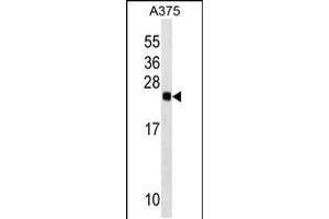 Western blot analysis in A375 cell line lysates (35ug/lane). (RAB2B antibody  (AA 105-131))