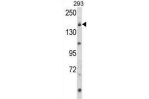 Western Blotting (WB) image for anti-Unc-13 Homolog B (UNC13B) antibody (ABIN3003956) (UNC13B antibody)