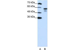 WB Suggested Anti-U2AF2 Antibody Titration:  1. (U2AF2 antibody  (N-Term))