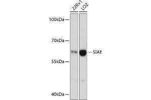 Western blot analysis of extracts of various cell lines, using SIAE antibody (ABIN6132918, ABIN6147755, ABIN6147756 and ABIN6217135) at 1:3000 dilution. (SIAE antibody  (AA 270-450))