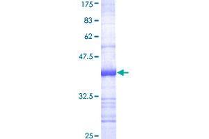 Image no. 1 for ADAM Metallopeptidase Domain 17 (ADAM17) (AA 215-314) protein (GST tag) (ABIN1305853)