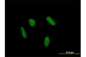 Immunofluorescence of purified MaxPab antibody to ZNF436 on HepG2 cell. (ZNF436 antibody  (AA 1-470))