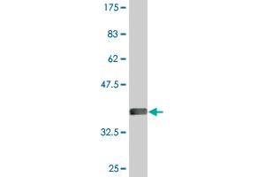 Western Blot detection against Immunogen (36. (ODF2 antibody  (AA 706-804))