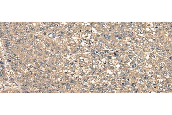 CCDC102A antibody