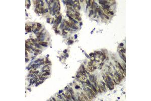 Immunohistochemistry of paraffin-embedded human colon carcinoma using TEAD1 antibody at dilution of 1:100 (x40 lens). (TEAD1 antibody)