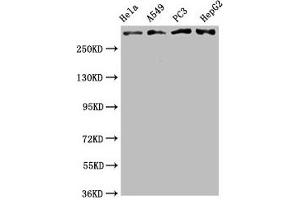 Western Blot Positive WB detected in: Hela whole cell lysate, A549 whole cell lysate, PC3 whole cell lysate, HepG2 whole cell lysate All lanes: ATM antibody at 2. (Recombinant ATM antibody)