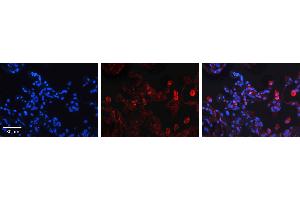 Immunohistochemistry (IHC) image for anti-Sphingolipid Delta(4)-Desaturase DES1 (DEGS1) (N-Term) antibody (ABIN2782243) (DEGS1 antibody  (N-Term))